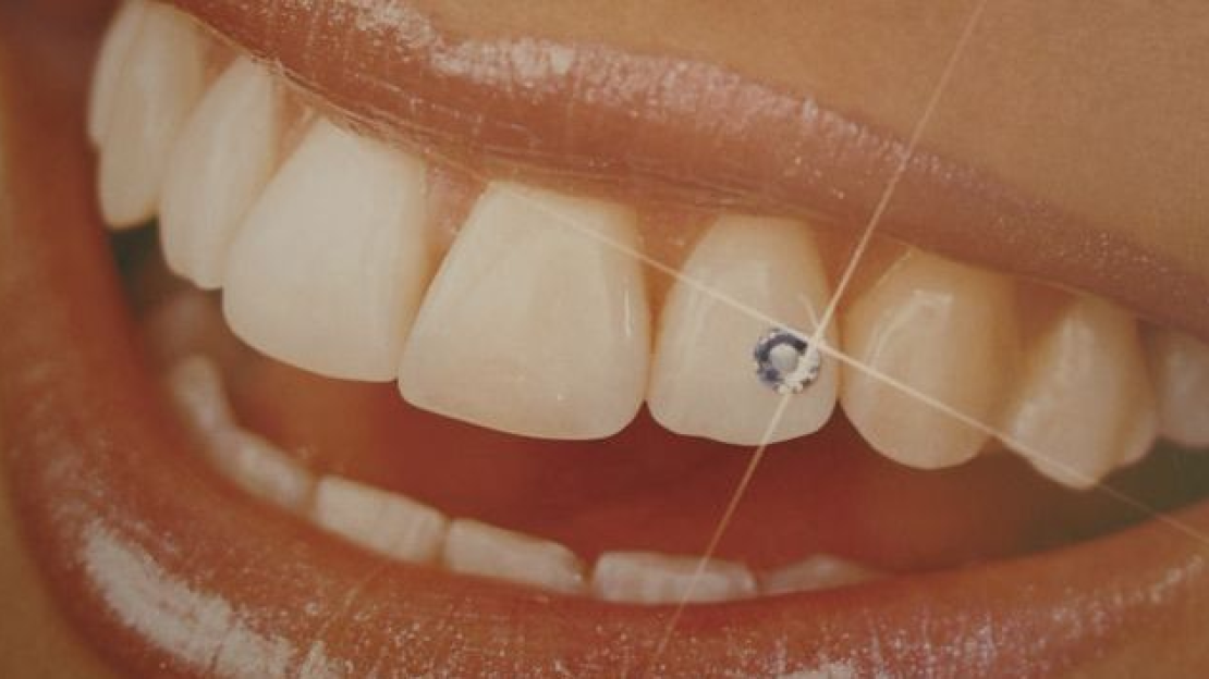 A mosoly a legelőnyösebb ékszer