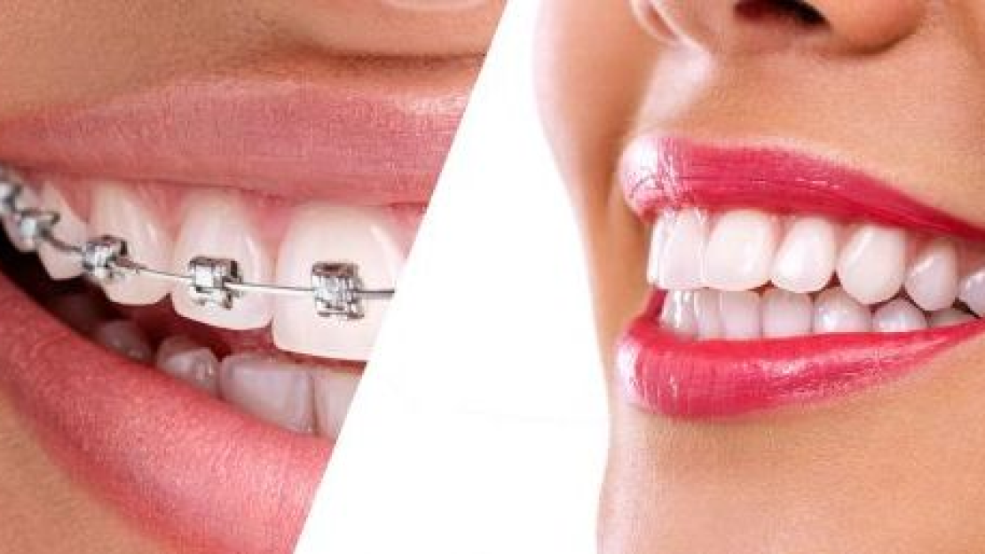 Amikor akasztják a hóhért...1.rész