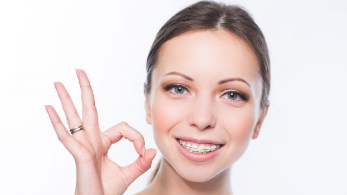 14 nap a fogszabályozóval