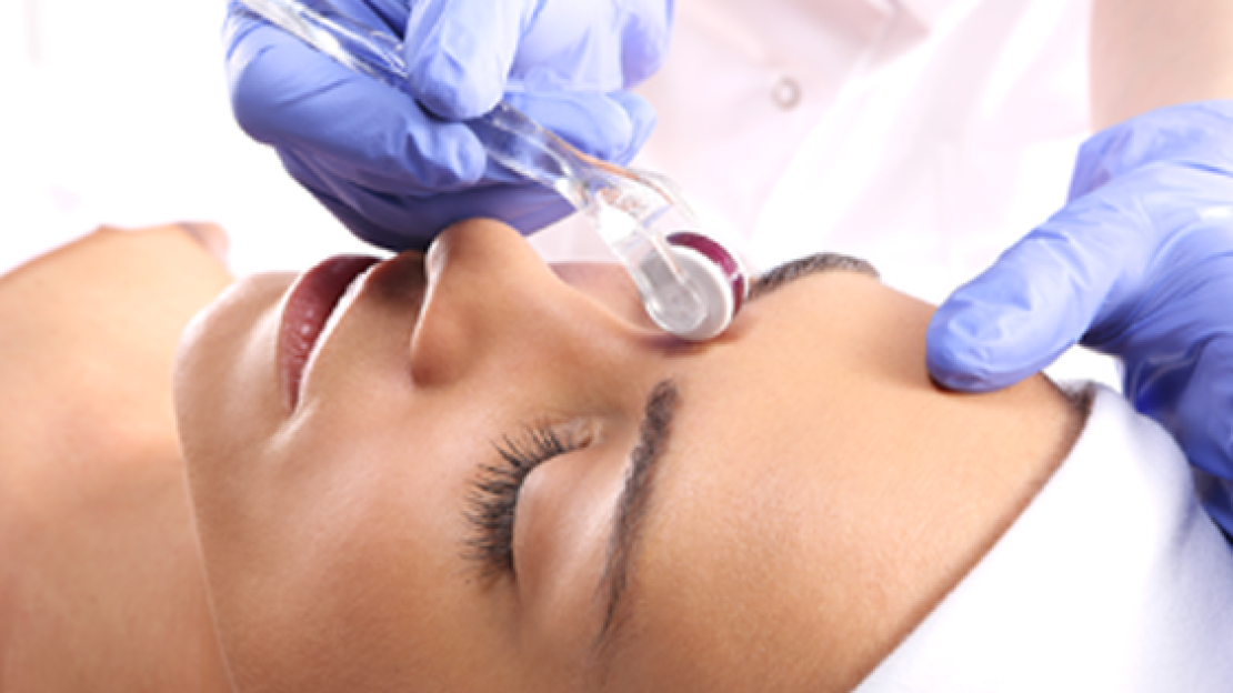 Otthoni ápolás kezelés után 4.