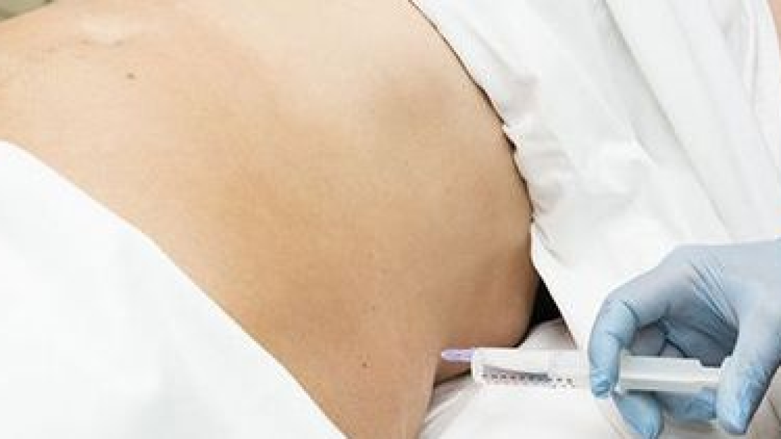 Otthoni ápolás kezelés után 7.