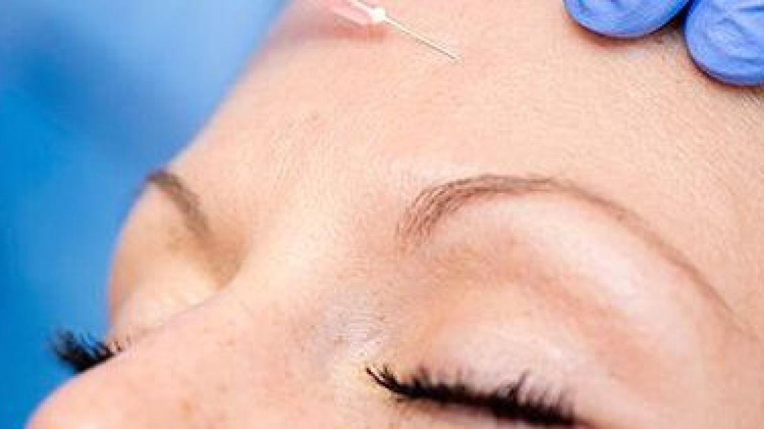 Otthoni ápolás kezelés után 9.