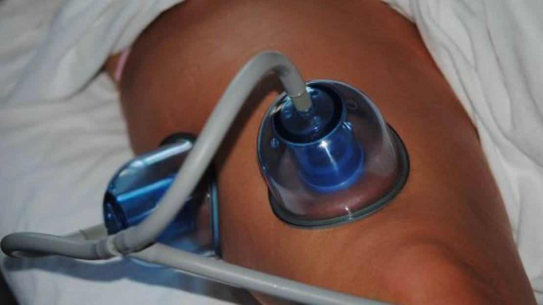 Otthoni ápolás kezelés után 15.