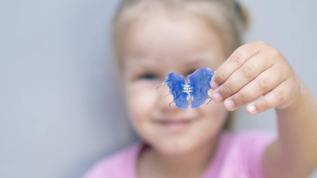 Gyermek fogszabályozás: időben érdemes elkezdeni