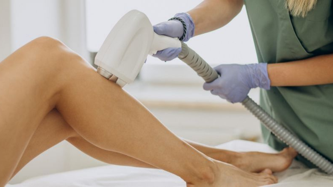 Mire érdemes figyelni lézeres szőrtelenítés után?