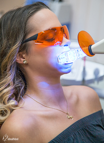 fogfehérítés uv fénnyel otthoni fogfehérítés árak Budapest