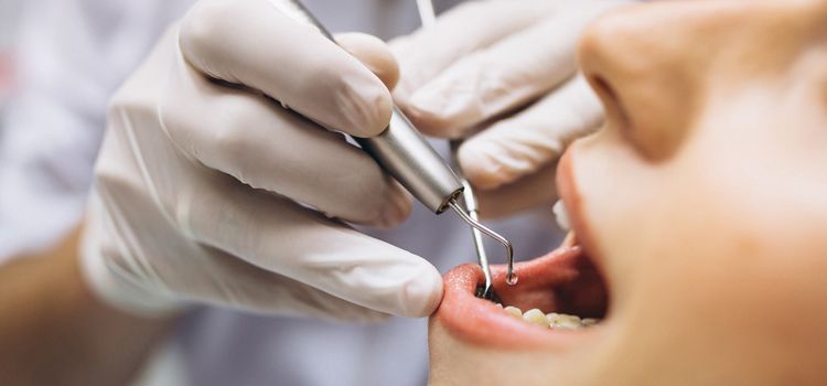 otthoni fogfehérítés árak Budapest