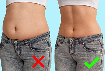 rádiófrekvenciás alakformálás ideális külső könnyedén