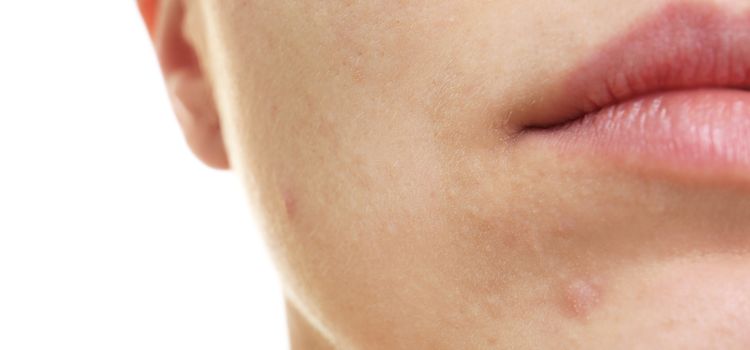 Arctisztítás eredménye a selymes fiatalos egészséges bőr