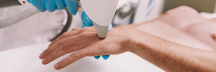 lézeres szőrtelenítés ár fájdalommentes szőrtelenítéshez