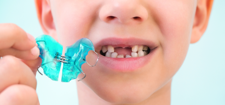 gyermek fogszabályozás során vidám színeket és mintákat használunk