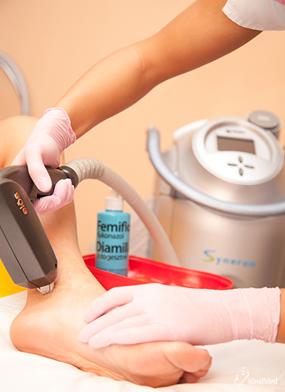 értágulatok kezelése lézertechnológiával