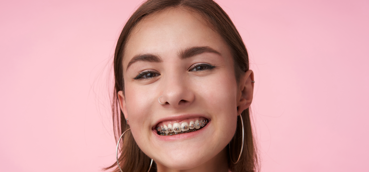 tinédzsereknek is szól a gyermek fogszabályozás