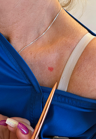 Slim derm pont Dermal piercing