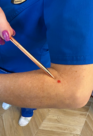 Szív és érrendszeri derm pont Dermal piercing